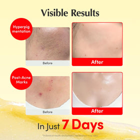 Utilisation de la crème EQQUALBERRY sur le visage