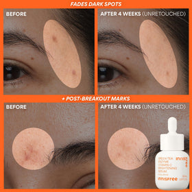 Utilisation du sérum Vitamine C dans une routine quotidienne