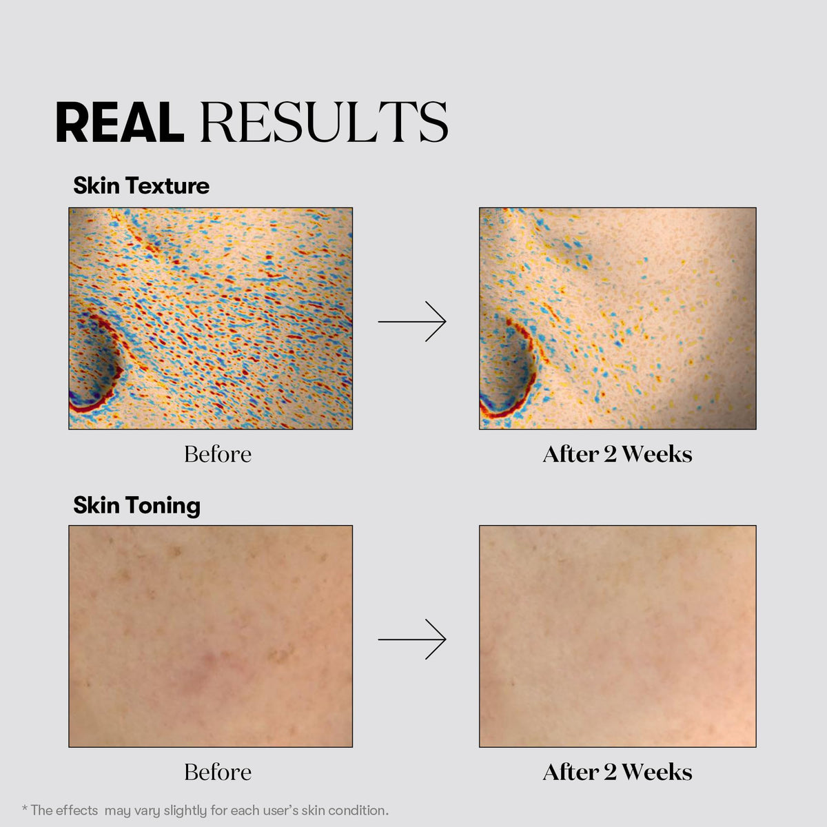 VT COSMETICS Masque Toning texture du masque
