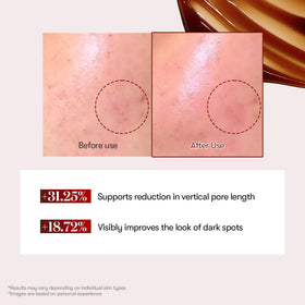 VT COSMETICS Sérum Red support Reedle Shot 50ml packaging