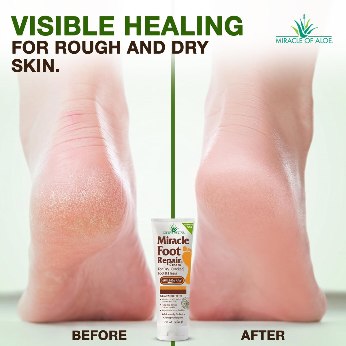 Vue de dos du tube de crème réparatrice des pieds Miracle of Aloe