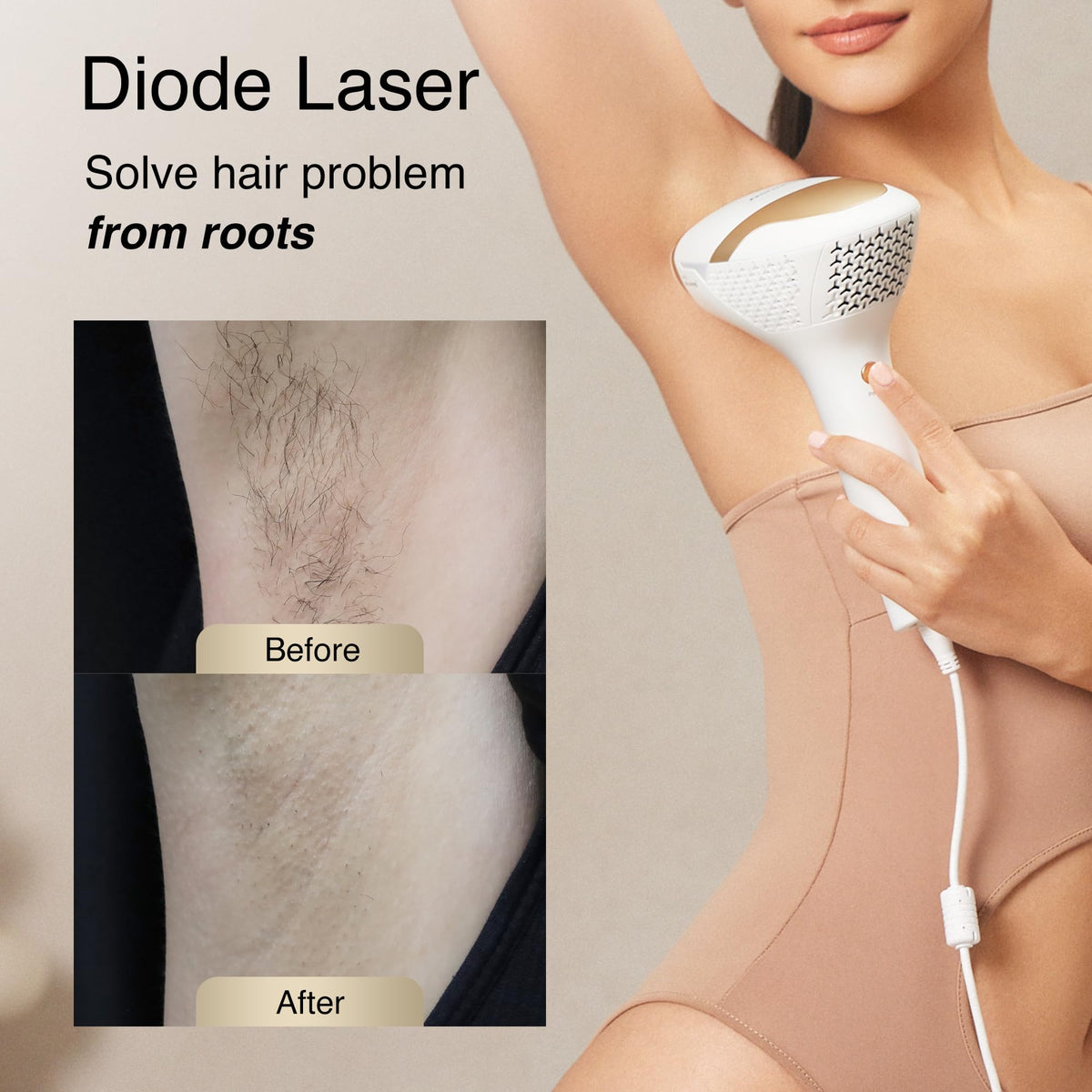 Vue de l'arrière de l'épilateur laser DermRays
