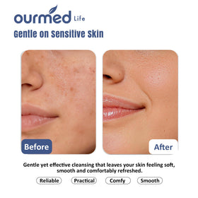 Vue rapprochée des serviettes éphémères ourmed life montrant la texture
