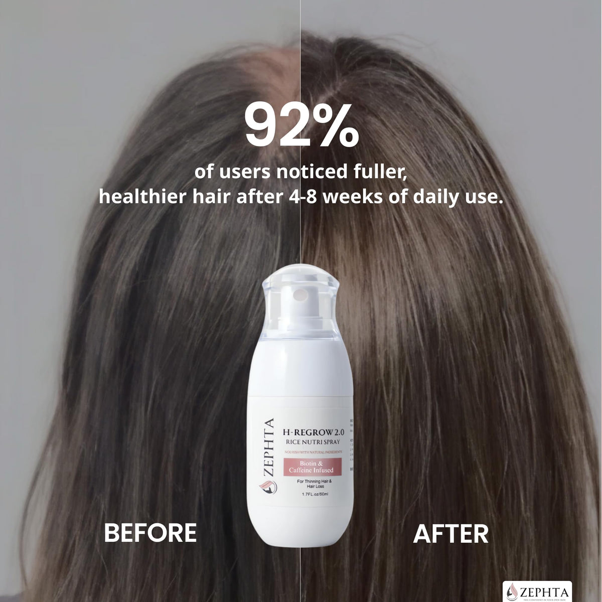 Zephta H-Regrow spray en gros plan des ingrédients