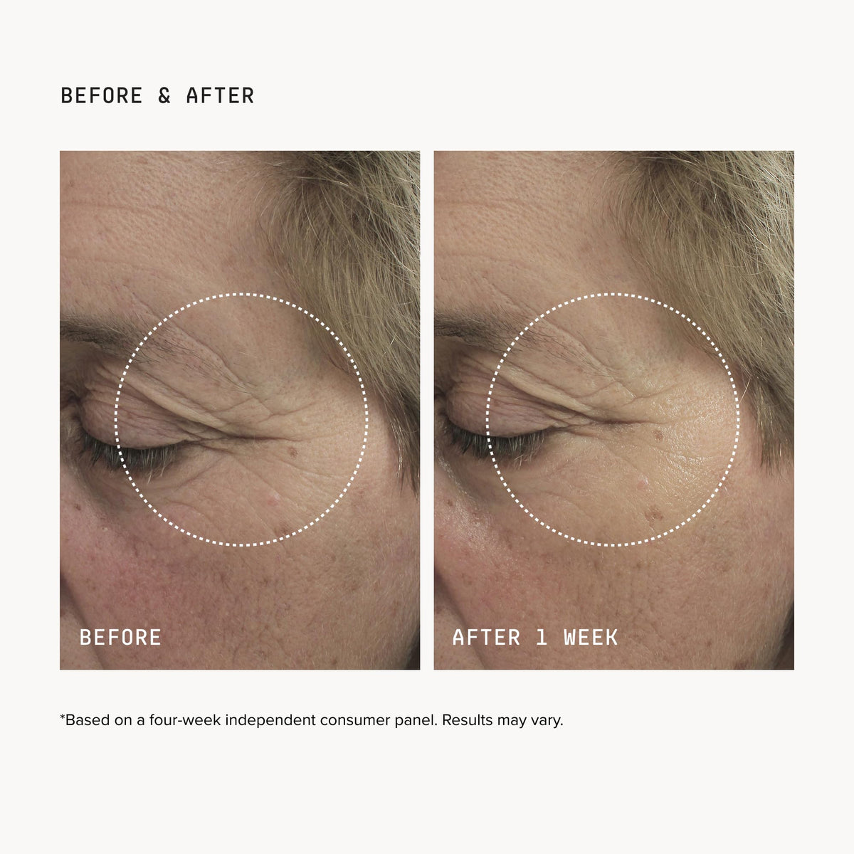 Zoom sur le masque contour des yeux DRMTLGY en hydrogel