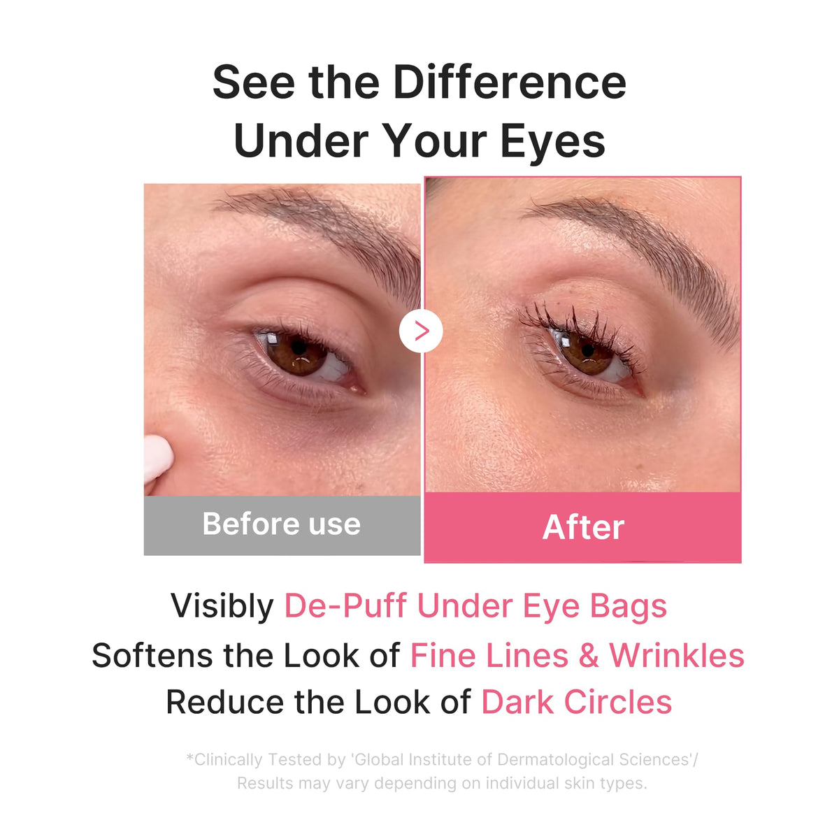 Zoom sur un patch hydrogel médicube Jelly Eye Mask PDRN